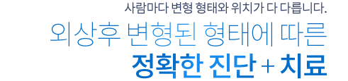 사람마다 변형 형태와 위치가 다 다릅니다. 외상후 변형된 형태에 따른 정확한 진단 + 치료